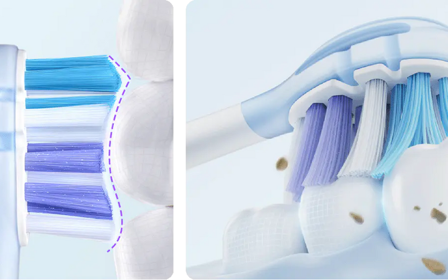 How Often Should You Change Your Electric Toothbrush Head? - usmile