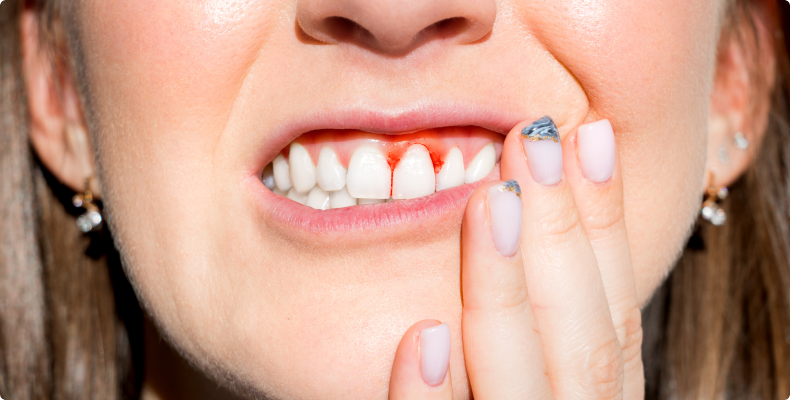 The Silent Threats to Your Smile: 5 Oral Diseases You’ve Probably Never Heard Of