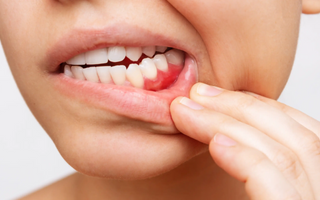 How long until a tooth infection kills you?