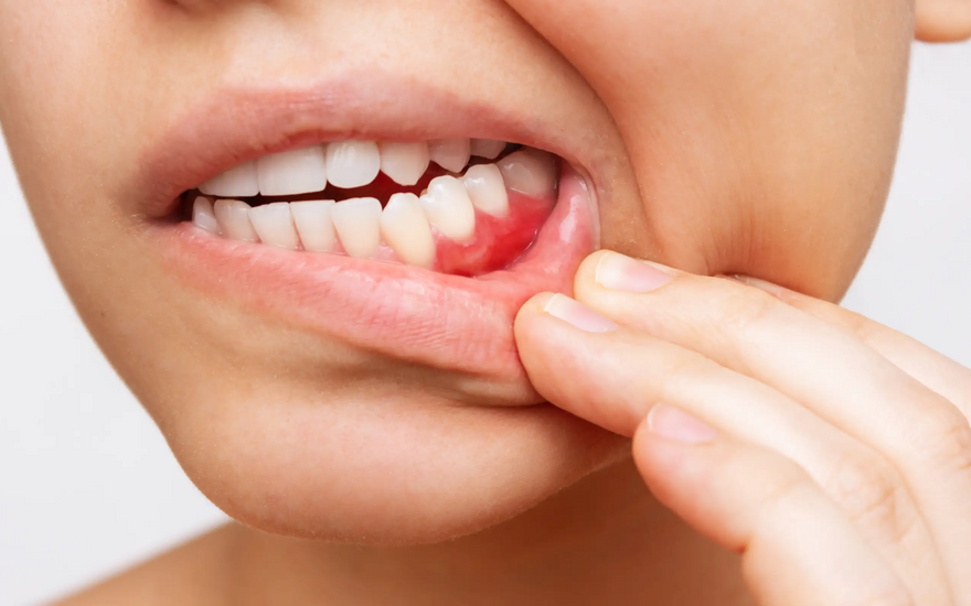 How long until a tooth infection kills you?