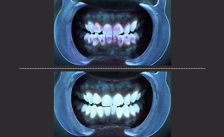 How to Maintain Oral Hygiene: 7 Smart Dentist Tips for a Healthy Smile