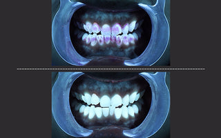 How to Maintain Oral Hygiene: 7 Smart Dentist Tips for a Healthy Smile