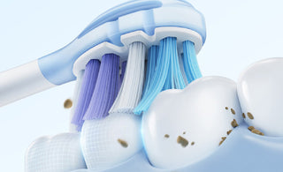 White Stains On Teeth: How To Get Rid Of Them?