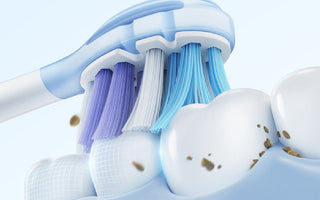 White Stains On Teeth: How To Get Rid Of Them?