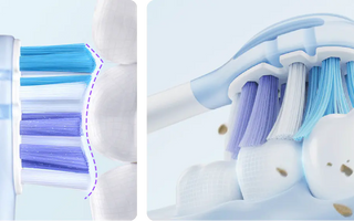 How Often Should You Change Your Electric Toothbrush Head? - usmile