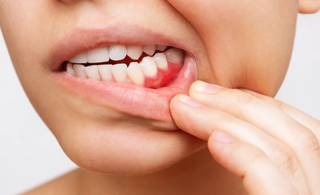 How long until a tooth infection kills you?