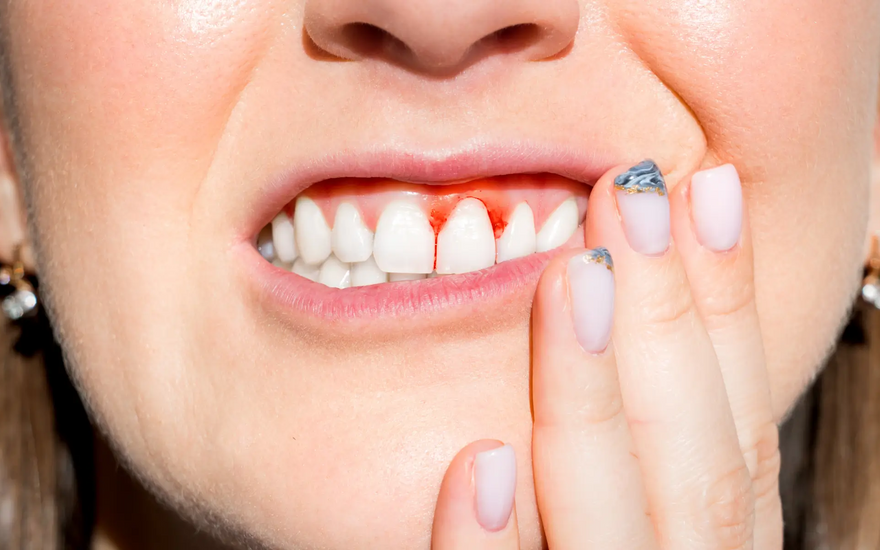 When Do Babies Start Teething? A Parent’s Guide