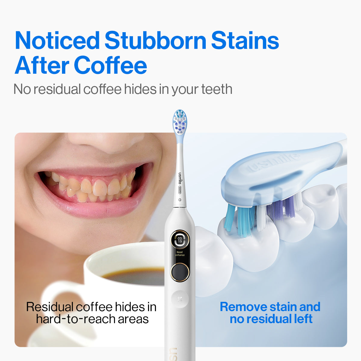usmile Y10 Pro Electric Toothbrush - usmile