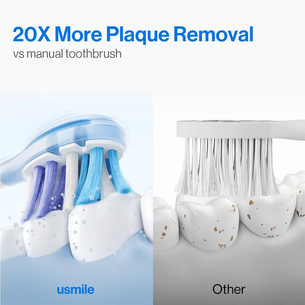 usmile Y10 Pro Electric Toothbrush - usmile